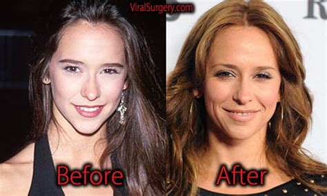 jennifer love hewitt implants|Jennifer Love Hewitt Addresses Plastic Surgery Speculation 